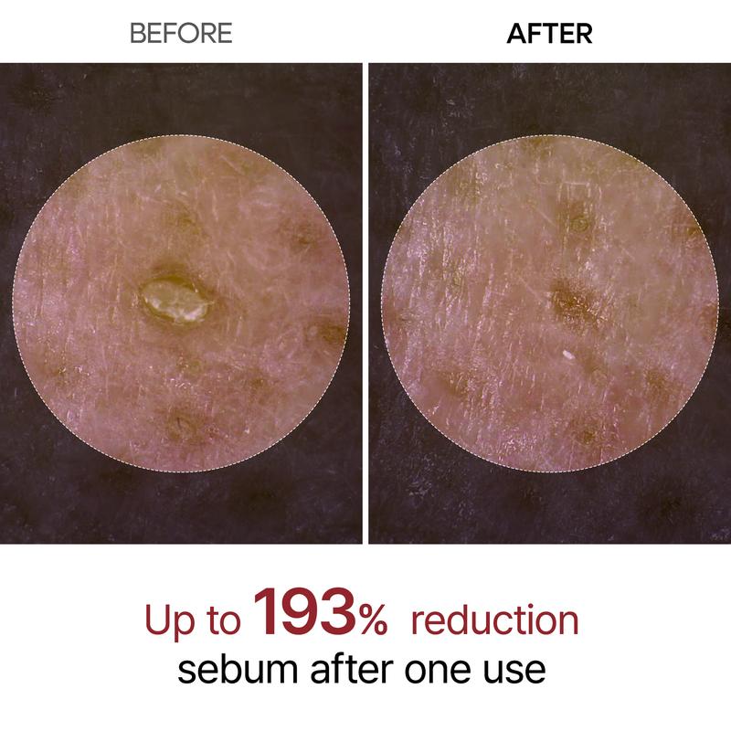 Peel Shot Exfoliator