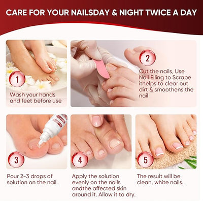 Dermfree Fungi Nail