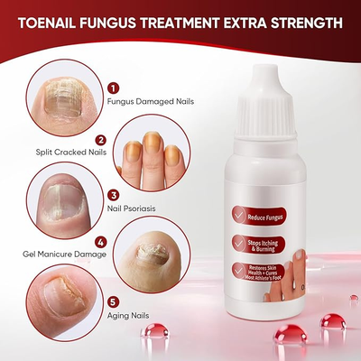 Dermfree Fungi Nail